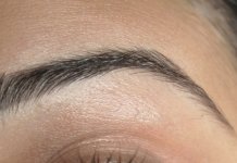 Laser frakcyjny a tryb życia pacjenta – komu łatwiej wpisać ten zabieg w codzienność? laser frakcyjny 3.jpg