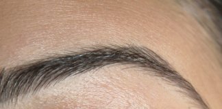 Laser frakcyjny a tryb życia pacjenta – komu łatwiej wpisać ten zabieg w codzienność? laser frakcyjny 3.jpg